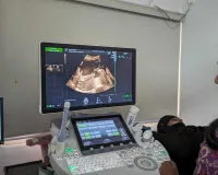 सूरत : सिविल अस्पताल में सोनोग्राफी मशीन से  मरीजों को मिल रही सुपर स्पेशलिटी सुविधाएं 