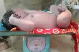 आसाम : महिला ने दिया राज्य के सबसे वजनदार बच्चे को जन्म, जन्म के समय था इतना भारी