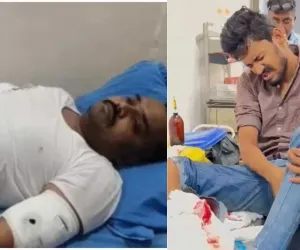सूरत : किशोर की हत्या के आरोपी द्वारा कांस्टेबल पर चाकू से हमला, स्वबचाव में पुलिस ने की फायरींग